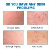 EELHOE Hyaluronic Acid Face Serum, Moisturizing Repair Lighten Acne Mark Skin Care Whitening Essence