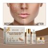 EELHOE Wild Yam Moisturizing Skin Care Set, Hydrating And Moisturizing Skin Care Cream Lotion Refreshing And Non-Greasy