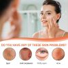EELHOE Brightening Whitening Cream Brightening Skin To Cover Spot Acne Marks Natural No Fake White Lazy Skin Cream