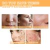 EELHOE Glycolic Acid 7% Toner, Remove Acne Lighten Acne Repair Acne Mark Moisturize Skin Toner