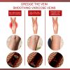 EELHOE Aricose Veins Medical Cream, Relieve Leg Swelling Earthworm Leg Vein Massage To Relieve Pain