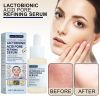 Jaysuing Lactose Solution, Exfoliate Remove Blackheads Shrink Pores Clean And Moisturize SkinEssence