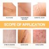 Ximonth Melittin Spray For Reducing Postpartum Pregnancy Scars Smoothing Skin Body Care Spray