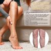 South Moon Instant Relief Varicose Vein Herbal Patch, Vein Massage To Relieve Leg Soreness And Swelling Earthworm Leg Care Patch